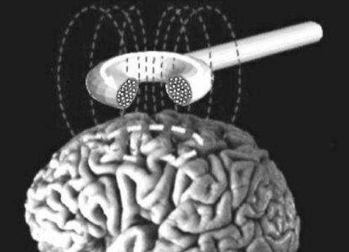 戒毒创新举措：经颅磁戒毒、VR戒毒等