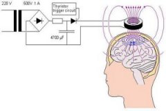 关于经颅磁治疗仪，你知道多少?